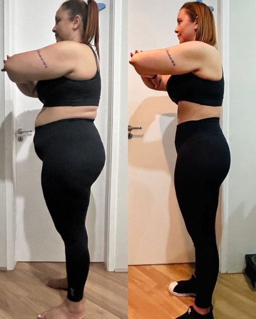Foto de evolução antes e depois de paciente acompanhada pelo método NEXO
